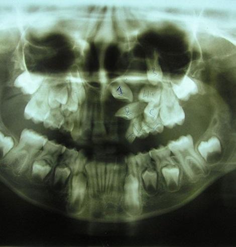 οδοντιατρος ορθοδοντικος, ροδος δωδεκανησα, πετας στυλιανος---doctors4u.gr