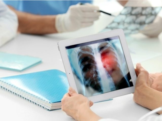 ΕΠΕΜΒΑΤΙΚΟΣ ΠΝΕΥΜΟΝΟΛΟΓΟΣ ΑΜΠΕΛΟΚΗΠΟΙ ΑΤΤΙΚΗΣ | ΝΤΑΟΥΛΗ ΟΥΡΑΝΙΑ