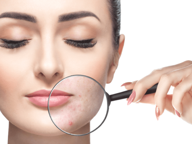 ΔΕΡΜΑΤΟΛΟΓΟΣ ΛΑΜΙΑ | ΠΑΠΑΝΙΚΟΛΑΟΥ ΣΠΥΡΙΔΩΝ