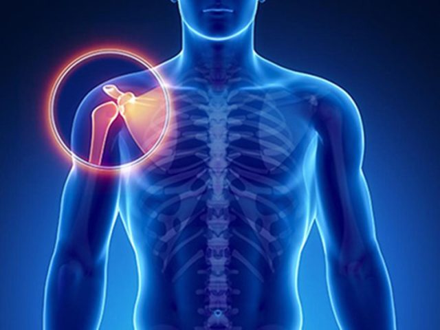 ΧΕΙΡΟΥΡΓΟΣ ΟΡΘΟΠΕΔΙΚΟΣ ΜΑΡΟΥΣΙ ΑΤΤΙΚΗΣ | ΧΙΩΤΗΣ Ν. ΙΩΑΝΝΗΣ