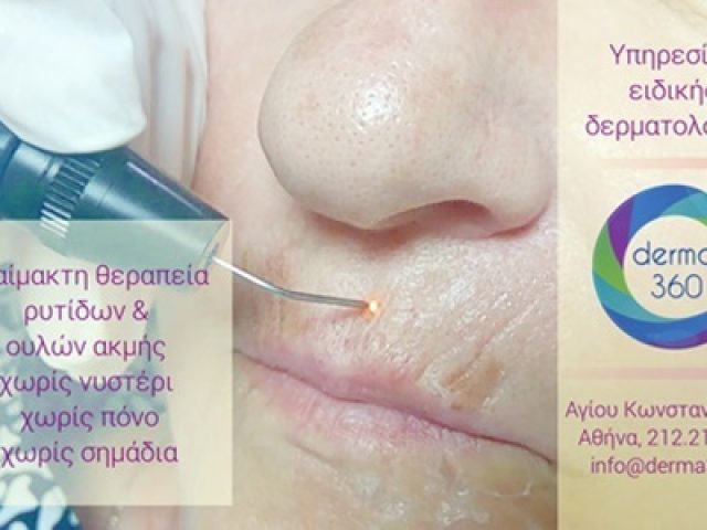 ΑΦΡΟΔΙΣΙΟΛΟΓΟΣ ΔΕΡΜΑΤΟΛΟΓΟΣ OMONOIA | ΛΙΑΚΟΠΟΥΛΟΣ ΔΕΡΜΑ360