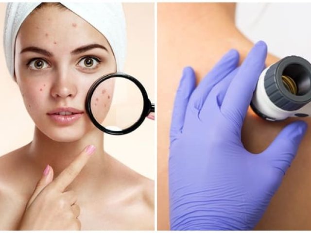 ΔΕΡΜΑΤΟΛΟΓΟΣ ΠΕΡΑΙΑ ΘΕΣΣΑΛΟΝΙΚΗ | ΕΛΕΥΘΕΡΙΑΔΗΣ ΒΛΑΣΙΟΣ