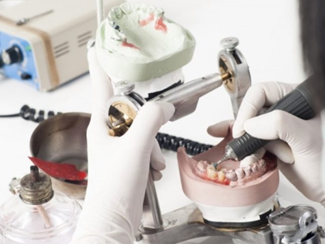 ΟΔΟΝΤΟΤΕΧΝΙΚΟ ΕΡΓΑΣΤΗΡΙΟ ΘΕΣΣΑΛΟΝΙΚΗ | DENTAL 88