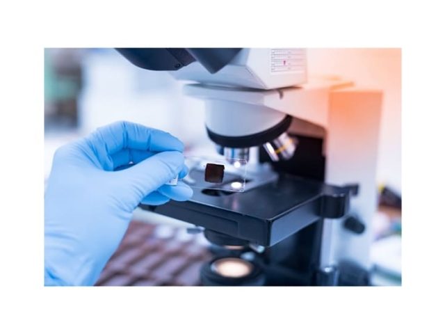 ΠΑΘΟΛΟΓΟΣ ΜΥΚΟΝΟΣ | LONDON CLINIC