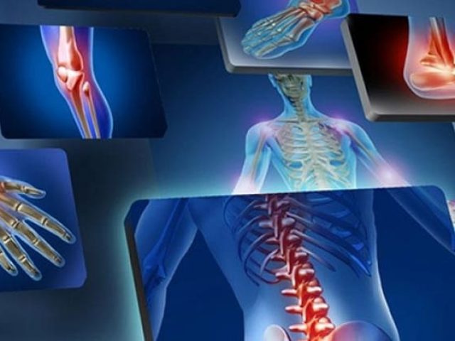 ΧΕΙΡΟΥΡΓΟΣ ΟΡΘΟΠΕΔΙΚΟΣ ΚΑΛΑΜΑΤΑ | ΚΑΠΕΡΝΕΚΑ ΘΕΟΔΩΡΑ